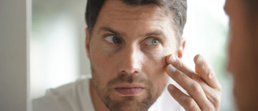 Porque é que aparece caspa nas sobrancelhas: como eliminá-la