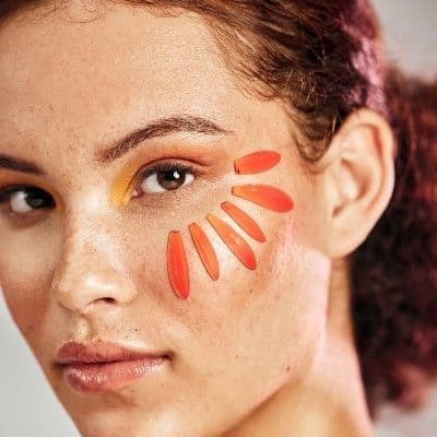 Lentigo solar: diferenças em relação ao melanoma e como eliminá-los