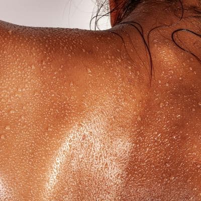 Porque é que o suor e o atrito da roupa podem favorecer o aparecimento de quistos sebáceos nas costas