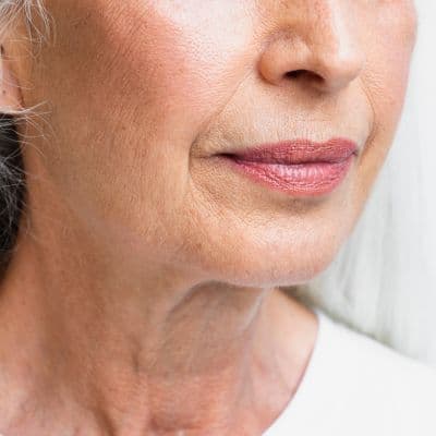 Rugas nos lábios? O truque para as atenuar sem injeções nem agulhas